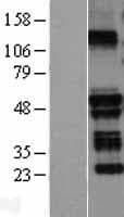 BIA2 / TRIM58 Protein (Over-Expression Lysate Myc-DDK (Flag))