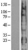 Human PTTG1IP / PBF Protein (Over-Expression Lysate Myc-DDK (Flag))