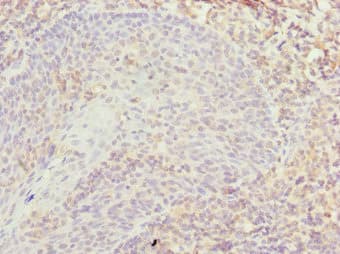 Polyclonal Rabbit anti-Human TXNL4B Antibody (IHC)