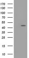 TASP1 Antibody (clone OTI1H6)