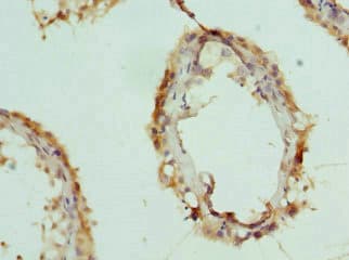 CPSF3L Antibody