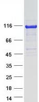 Human HIP1R Protein (Recombinant Myc-DDK (Flag))