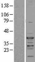 NFYC Protein (Over-Expression Lysate Myc-DDK (Flag))