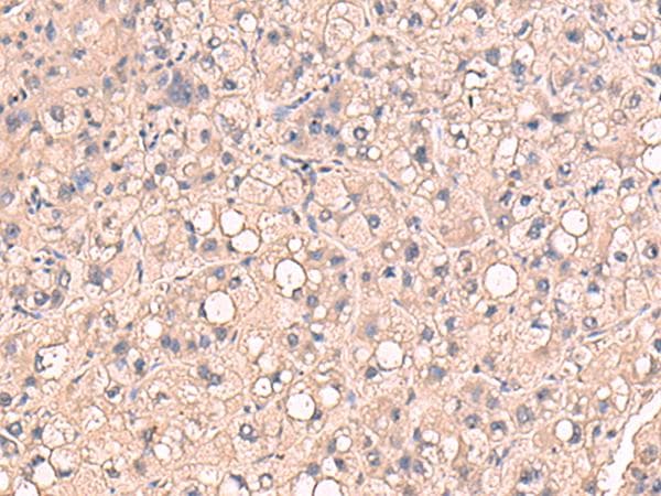 RIOK1 Antibody