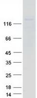 Human CDH2 / N Cadherin Protein (Recombinant Myc-DDK (Flag))
