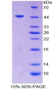 Bovine TGFB1 / TGF Beta 1 Protein (Recombinant His-GST)