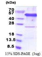 Human EIF3S5 / EIF3F Protein (Recombinant His)