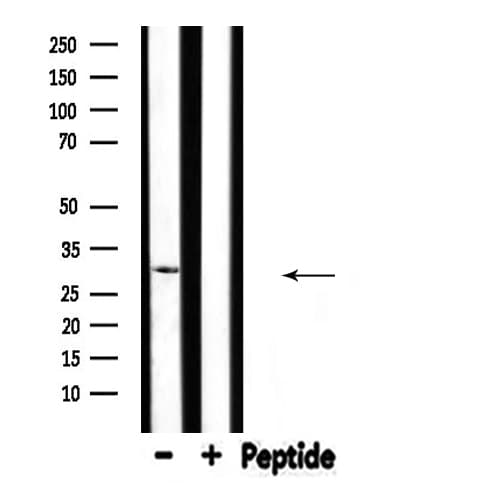 Polyclonal Rabbit anti-Human SFRP2 Antibody (IF, WB)