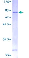 Human VEGFC Protein (Recombinant GST)