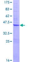 Human ZNF695 Protein (Recombinant GST)