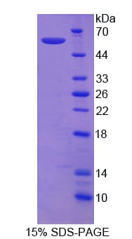 Human SEMA3E / Semaphorin 3E Protein (Recombinant His,N-terminus)