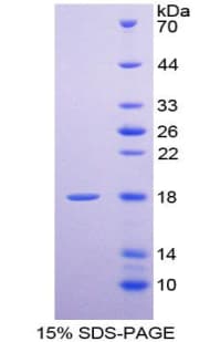 Human SELE / CD62E / E-selectin Protein (Recombinant His-T7)