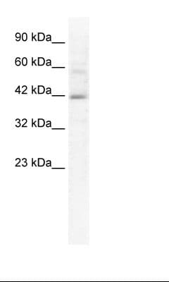KCTD10 Antibody (N-Terminus)