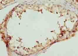 LRRC18 Antibody