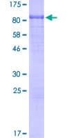 Human C1qRP / CD93 Protein (Recombinant GST, N-terminus)