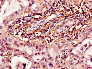 Polyclonal Rabbit anti-Human 15-PGDH / HPGD Antibody (IHC, IF)