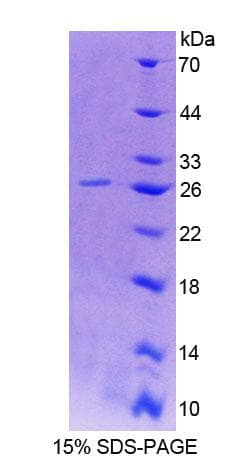 Rat CD48 Protein (Recombinant His-T7)