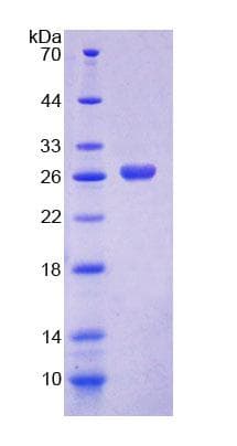 Human ME2 / Malate Dehydrogenase 2 Protein (Recombinant His-T7)