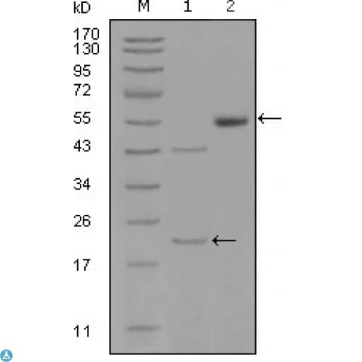 Monoclonal Mouse anti-Human EPHA5 / EPH Receptor A5 Antibody (WB)