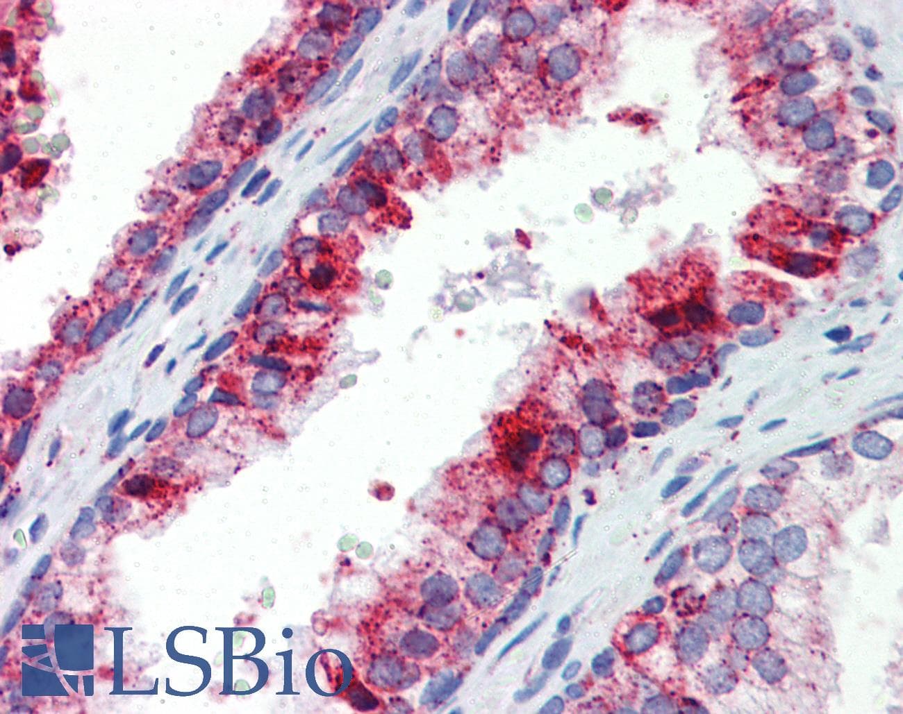 Polyclonal Rabbit anti-Human BCL11A Antibody (N-Terminus, IHC, WB)