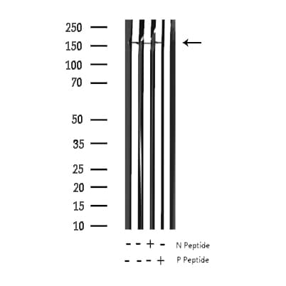 EGFR Antibody (phospho-Ser1070)