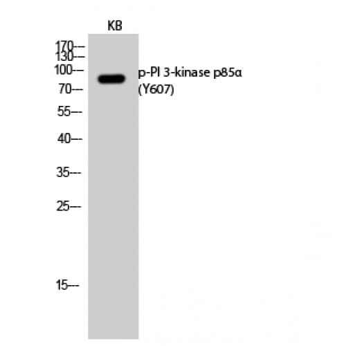 PIK3R1 / p85 Alpha Antibody (550-630 aa)