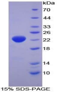 Human HSPB2 / HSP27 Protein (Recombinant His-T7)