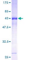 Human TROP2 / TACSTD2 Protein (Recombinant GST)