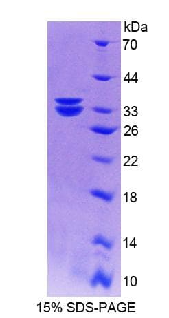 Human MTUS1 Protein (Recombinant His-T7)