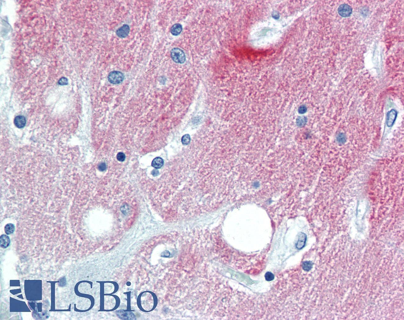 PathPlus™ L1CAM Antibody (clone UJ127.11)