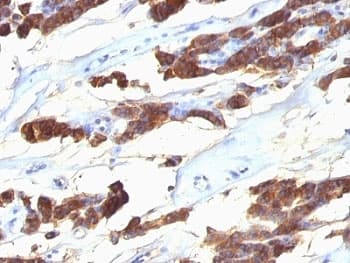 TG / Thyroglobulin Antibody (clone SPM221)