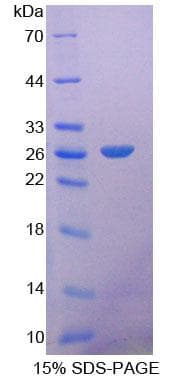 Human FGF21 Protein (Recombinant His-T7)
