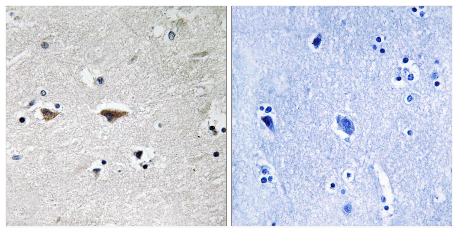 Polyclonal Rabbit anti-Human SRC Antibody (p75, IHC, WB)