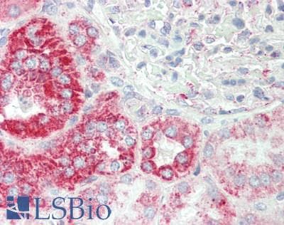 IHC-plus™ Prohibitin 2 / PHB2 Antibody (Internal)
