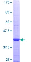 Human SLC4A1 / Band 3 / AE1 Protein (Recombinant GST, N-terminus)
