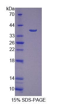 Human SSR1 Protein (Recombinant His-T7, N-terminus)
