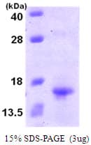 Human XCL1 / Lymphotactin Protein (Recombinant His)