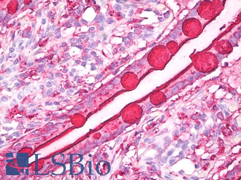 IHC-plus™ Lewis B Blood Group Antigen Antibody (clone 2-25LE)
