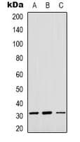 Polyclonal Rabbit anti-Human OTUB1 / OTU1 Antibody (Internal, WB)