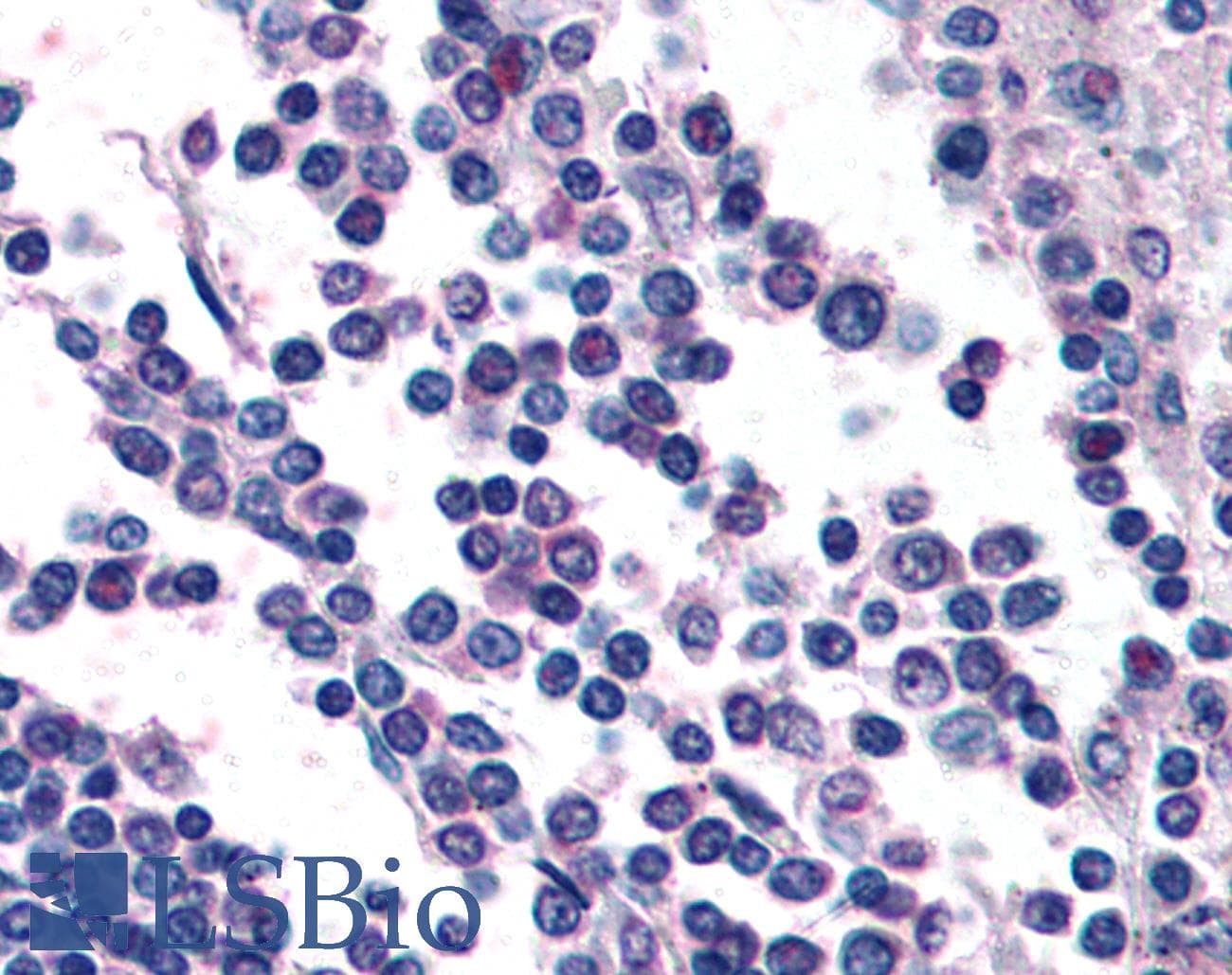 IHC-plus™ GPR132 / G2A Antibody (C-Terminus)