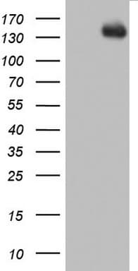 ZEB1 / AREB6 Antibody (aa1-350, clone OTI9G3)