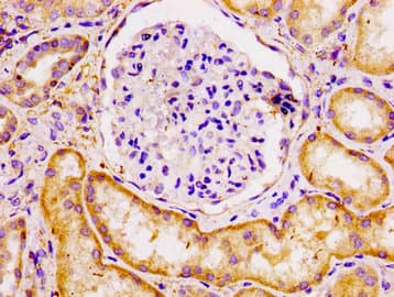 ECT2 Antibody