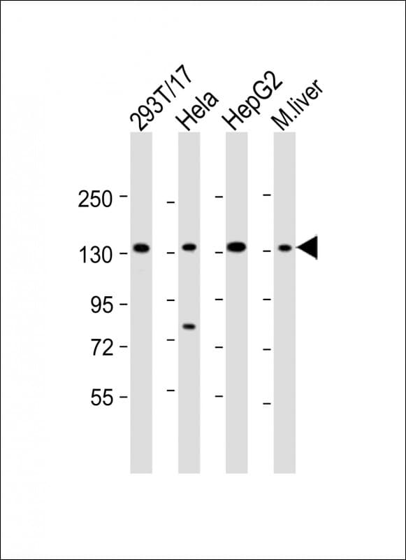 LRPPRC Antibody (aa847-876)