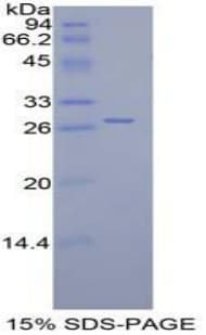 Human PTCH1 / Patched 1 Protein (Recombinant His-T7)