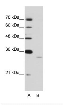 EXOSC6 Antibody (N-Terminus)