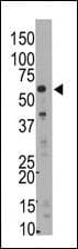 SMYD5 Antibody (aa341-371)