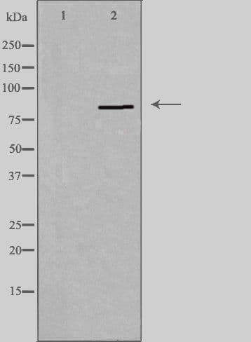 PNPLA8 Antibody
