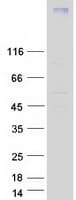 Human CCR7 Protein (Recombinant Myc-DDK (Flag))
