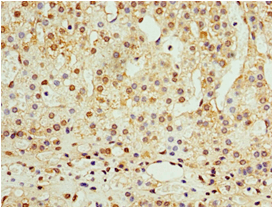 ADAP1 / CENTA1 Antibody (aa1-374)