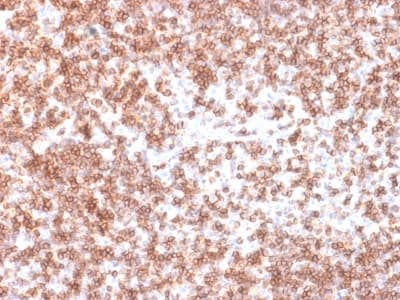 Recombinant Monoclonal Rabbit anti-Human CD45 / LCA Antibody (clone PTPRC/1975R, Azide-free,Carrier-free, IHC, WB)